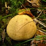 scleroderme verruqueux